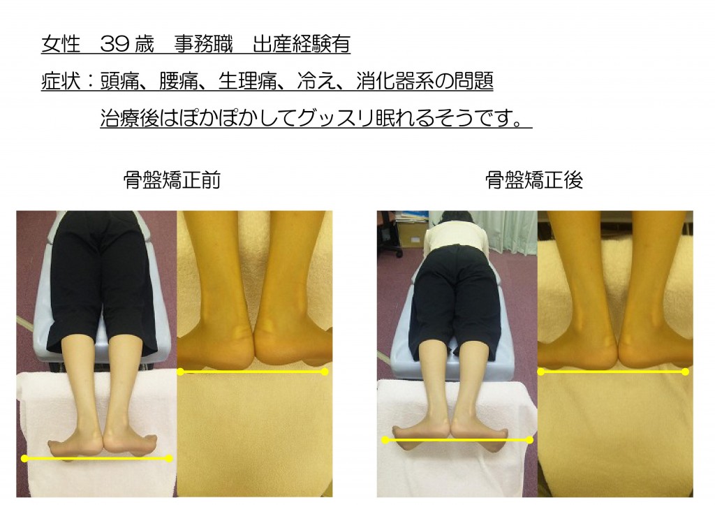 かつ神田整骨院の施術室で院長が患者様に骨盤矯正を行う様子